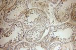 SFTPC Antibody in Immunohistochemistry (Paraffin) (IHC (P))