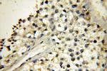 SFTPC Antibody in Immunohistochemistry (Paraffin) (IHC (P))