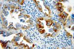 SFTPC Antibody in Immunohistochemistry (Paraffin) (IHC (P))