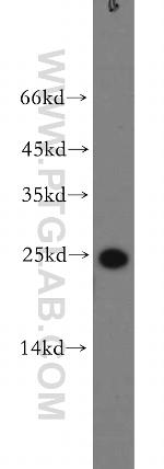 SFTPC Antibody in Western Blot (WB)