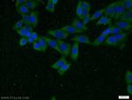 TRIP10 Antibody in Immunocytochemistry (ICC/IF)