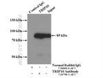 TRIP10 Antibody in Immunoprecipitation (IP)