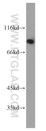 TRIP10 Antibody in Western Blot (WB)