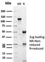 CFTR (Cystic Fibrosis Transmembrane Conductance Regulator) Antibody in SDS-PAGE (SDS-PAGE)