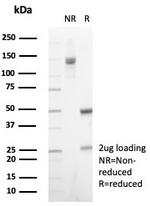 HCG-beta (Pregnancy and Choriocarcinoma Marker) Antibody in SDS-PAGE (SDS-PAGE)