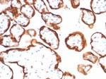 HCG-beta (Pregnancy and Choriocarcinoma Marker) Antibody in Immunohistochemistry (Paraffin) (IHC (P))