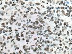 Histone H2A.X Antibody in Immunohistochemistry (Paraffin) (IHC (P))