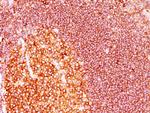 MALT1 (MALT-Lymphoma Marker) Antibody in Immunohistochemistry (Paraffin) (IHC (P))