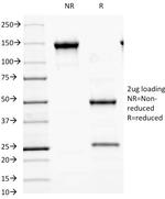 MALT1 (MALT-Lymphoma Marker) Antibody in SDS-PAGE (SDS-PAGE)