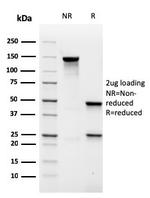 MALT1 Antibody in SDS-PAGE (SDS-PAGE)