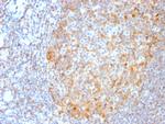 MALT1 Antibody in Immunohistochemistry (Paraffin) (IHC (P))