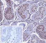 KIF2C (Kinesin Family Member 2C)/MCAK Antibody in Immunohistochemistry (Paraffin) (IHC (P))