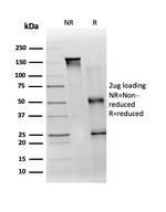 TDRKH Antibody in SDS-PAGE (SDS-PAGE)