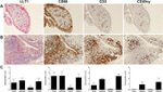 CD68 Antibody in Immunohistochemistry (IHC)