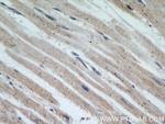 SHMT2 Antibody in Immunohistochemistry (Paraffin) (IHC (P))