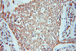 SHMT2 Antibody in Immunohistochemistry (Paraffin) (IHC (P))