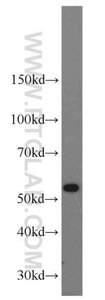 SHMT2 Antibody in Western Blot (WB)