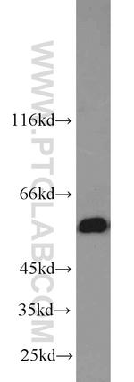 SHMT2 Antibody in Western Blot (WB)