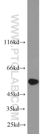 SHMT2 Antibody in Western Blot (WB)