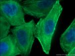 MYH9 Antibody in Immunocytochemistry (ICC/IF)