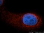 EIF3G Antibody in Immunocytochemistry (ICC/IF)