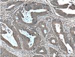 ALDOA Antibody in Immunohistochemistry (Paraffin) (IHC (P))