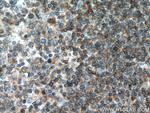 Integrin beta-7 Antibody in Immunohistochemistry (Paraffin) (IHC (P))