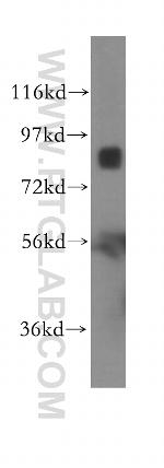 Integrin beta-7 Antibody in Western Blot (WB)