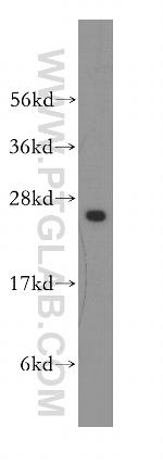 UMP/CMP kinase Antibody in Western Blot (WB)