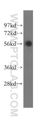 SLA/LP Antibody in Western Blot (WB)