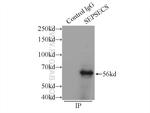 SLA/LP Antibody in Immunoprecipitation (IP)