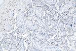 Cyclin E1 Antibody in Immunohistochemistry (Paraffin) (IHC (P))