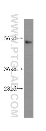 Cyclin E1 Antibody in Western Blot (WB)