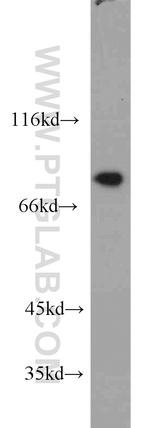 STIM1 Antibody in Western Blot (WB)