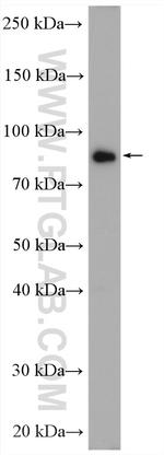 STIM1 Antibody in Western Blot (WB)