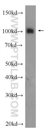 OGT Antibody in Western Blot (WB)