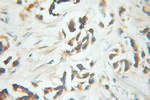 PNKD Antibody in Immunohistochemistry (Paraffin) (IHC (P))