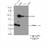 MCM5 Antibody in Immunoprecipitation (IP)