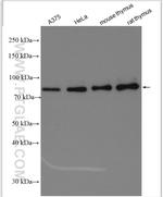 MCM5 Antibody in Western Blot (WB)