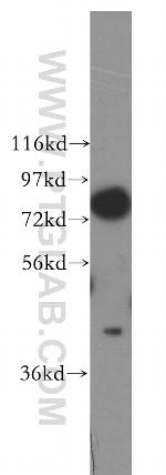 MCM5 Antibody in Western Blot (WB)