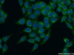 IFITM3 Antibody in Immunocytochemistry (ICC/IF)