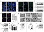 IFN gamma Antibody in Immunohistochemistry (IHC)