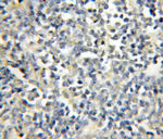 RAG2 Antibody in Immunohistochemistry (Paraffin) (IHC (P))