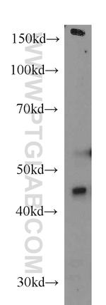 RSAD2 Antibody in Western Blot (WB)