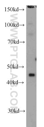 RSAD2 Antibody in Western Blot (WB)