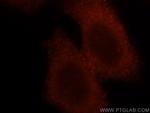 RSAD2 Antibody in Immunocytochemistry (ICC/IF)