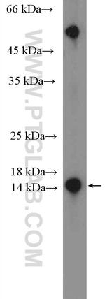 RBP5 Antibody in Western Blot (WB)