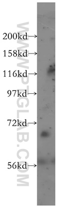 GBP2 Antibody in Western Blot (WB)