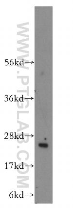 RABL3 Antibody in Western Blot (WB)