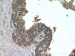 TMEFF2 Antibody in Immunohistochemistry (Paraffin) (IHC (P))